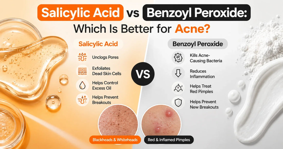 Salicylic Acid vs Benzoyl Peroxide Which Is Better for Acne?