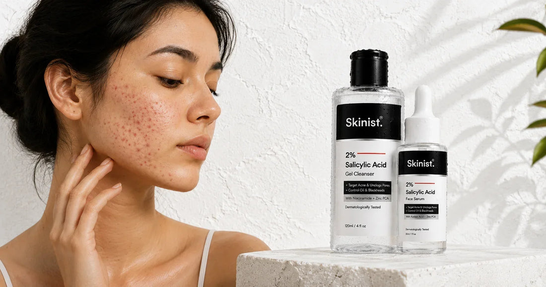 Why Salicylic Acid Cleanser Works for Acne-Prone Skin