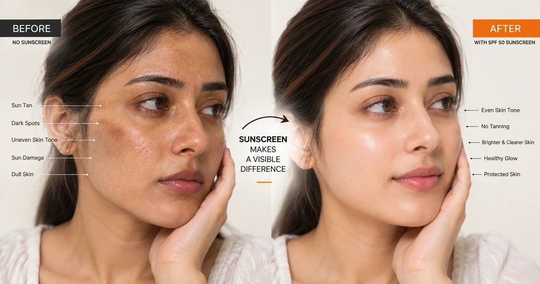 SPF 30 vs SPF 50 Which Sunscreen Is Better for Pakistani Skin?