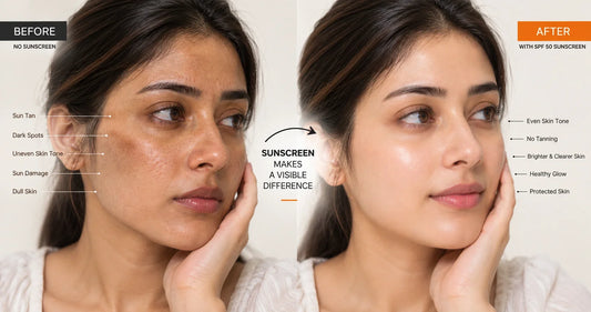 SPF 30 vs SPF 50 Which Sunscreen Is Better for Pakistani Skin?
