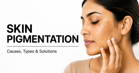 What Causes Pigmentation on Pakistani Skin?