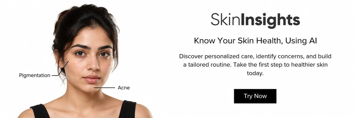 SkinInsights