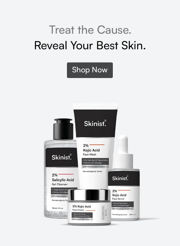 Skinist Mobile Banner